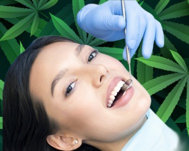CBD for oral health